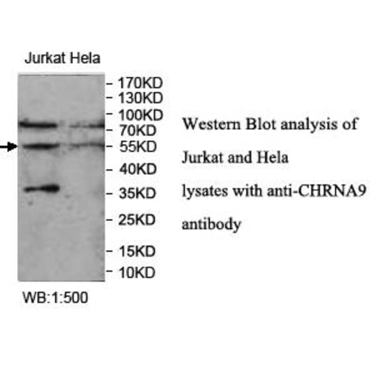 CHRNA9 Antibody from Signalway Antibody (39956) - Antibodies.com