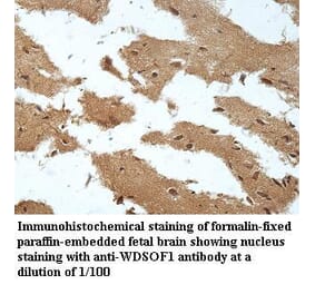 WDSOF1 Antibody from Signalway Antibody (39961) - Antibodies.com