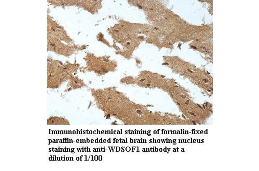 WDSOF1 Antibody from Signalway Antibody (39961) - Antibodies.com