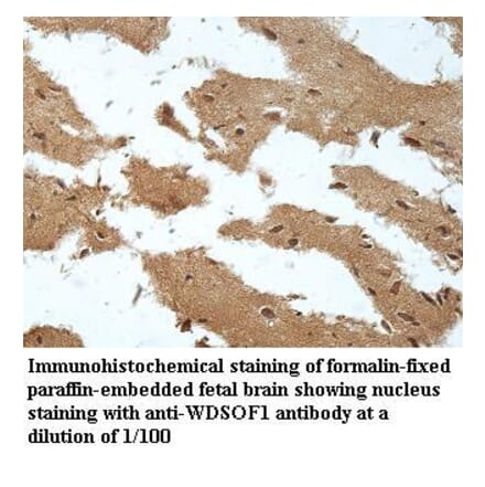 WDSOF1 Antibody from Signalway Antibody (39961) - Antibodies.com