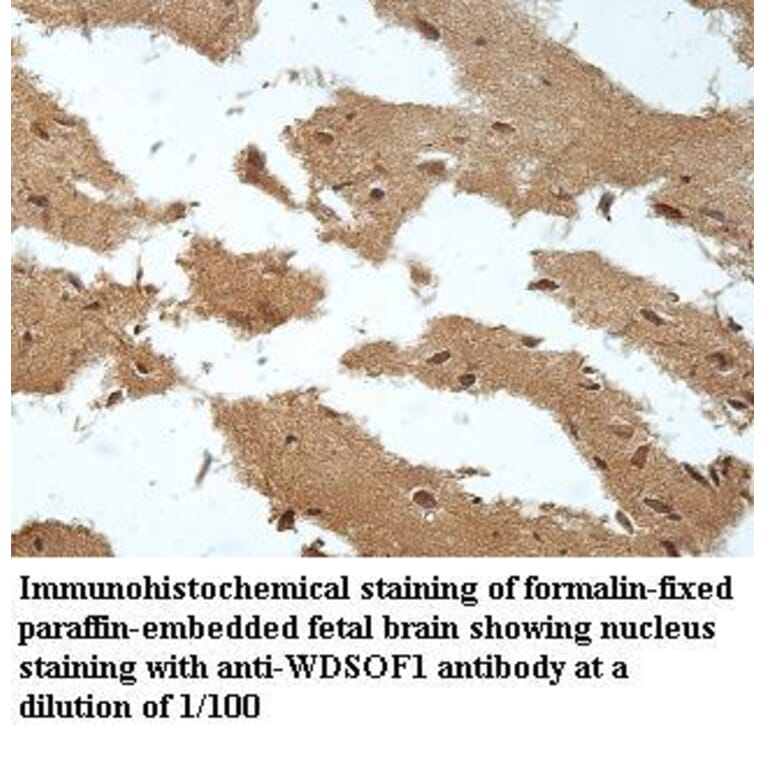 WDSOF1 Antibody from Signalway Antibody (39961) - Antibodies.com