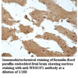 WDSOF1 Antibody from Signalway Antibody (39961) - Antibodies.com