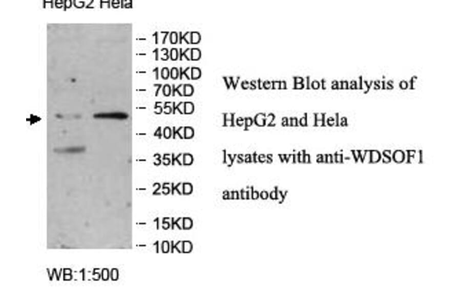WDSOF1 Antibody from Signalway Antibody (39961) - Antibodies.com