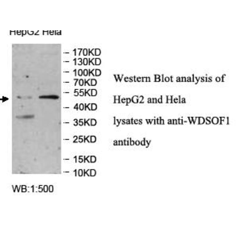 WDSOF1 Antibody from Signalway Antibody (39961) - Antibodies.com
