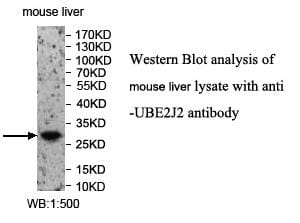 Anti-UBE2J2 Antibody