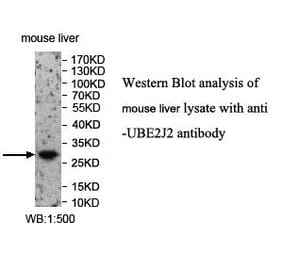 UBE2J2 Antibody from Signalway Antibody (39974) - Antibodies.com
