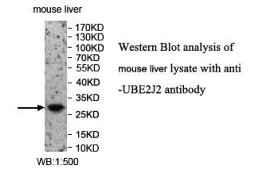 UBE2J2 Antibody from Signalway Antibody (39974) - Antibodies.com