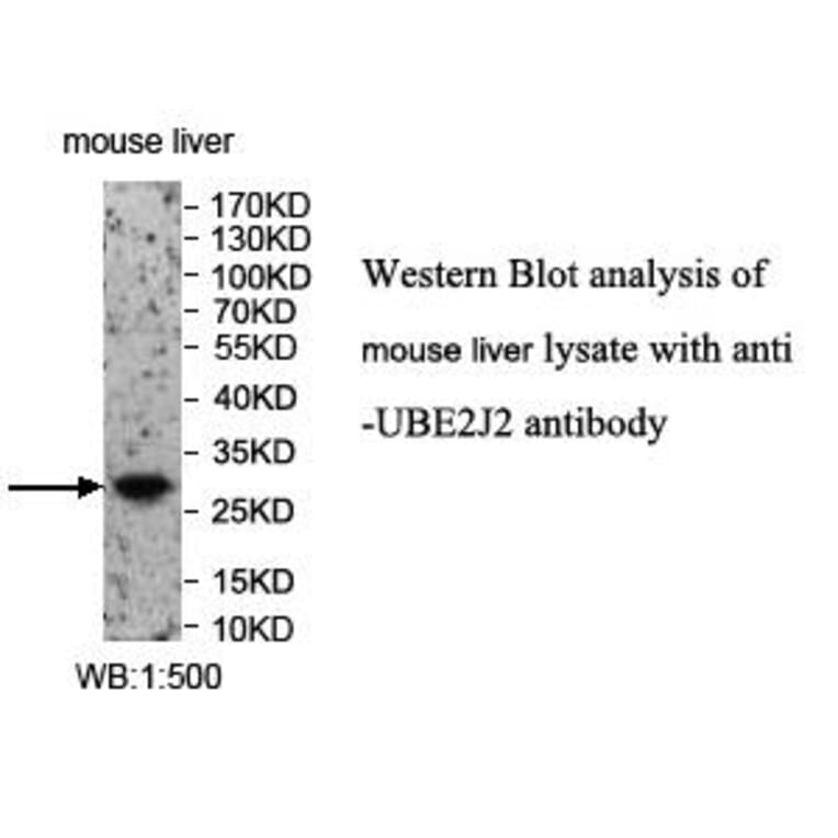 UBE2J2 Antibody from Signalway Antibody (39974) - Antibodies.com