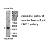 UBE2J2 Antibody from Signalway Antibody (39974) - Antibodies.com