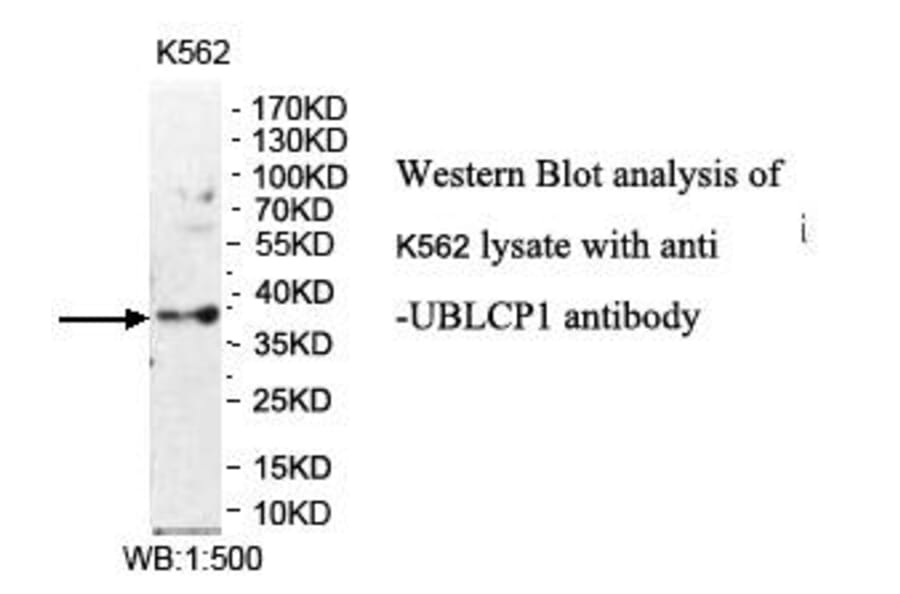 UBLCP1 Antibody from Signalway Antibody (39975) - Antibodies.com