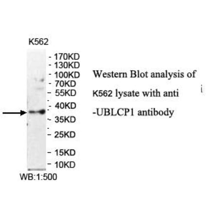 UBLCP1 Antibody from Signalway Antibody (39975) - Antibodies.com