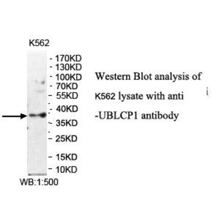 UBLCP1 Antibody from Signalway Antibody (39975) - Antibodies.com