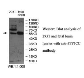 PPP3CC Antibody from Signalway Antibody (39978) - Antibodies.com