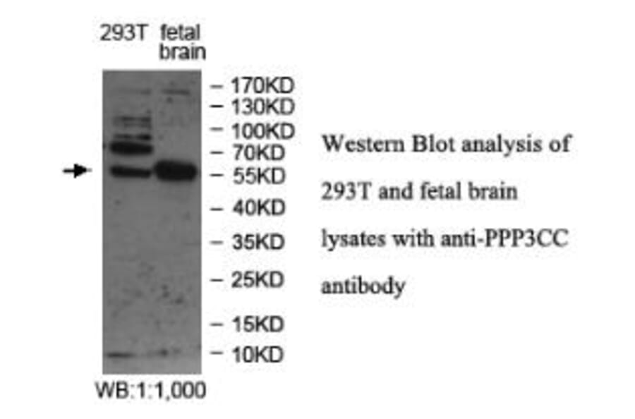 PPP3CC Antibody from Signalway Antibody (39978) - Antibodies.com