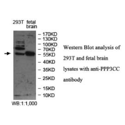 PPP3CC Antibody from Signalway Antibody (39978) - Antibodies.com