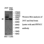 PPP3CC Antibody from Signalway Antibody (39978) - Antibodies.com