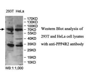 PPP4R2 Antibody from Signalway Antibody (39980) - Antibodies.com