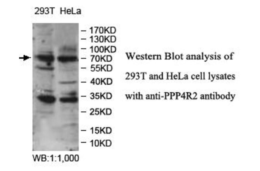 PPP4R2 Antibody from Signalway Antibody (39980) - Antibodies.com