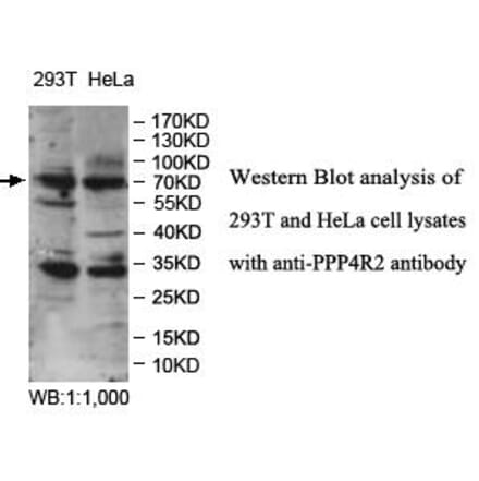 PPP4R2 Antibody from Signalway Antibody (39980) - Antibodies.com