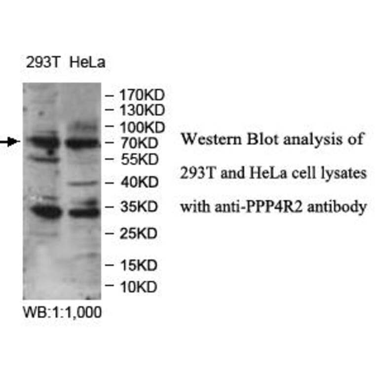 PPP4R2 Antibody from Signalway Antibody (39980) - Antibodies.com