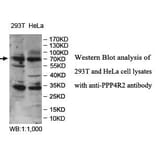 PPP4R2 Antibody from Signalway Antibody (39980) - Antibodies.com