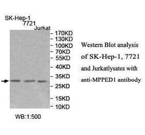 MPPED1 Antibody from Signalway Antibody (39994) - Antibodies.com