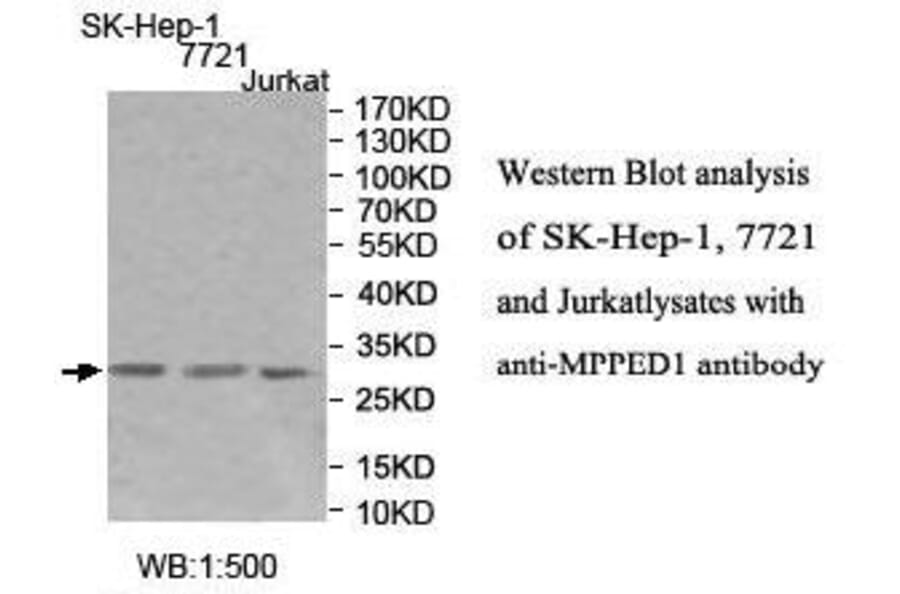 MPPED1 Antibody from Signalway Antibody (39994) - Antibodies.com