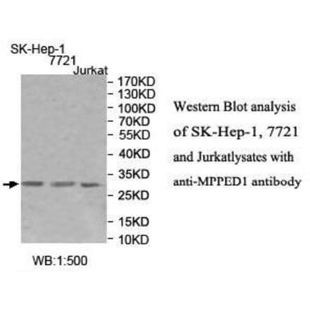 MPPED1 Antibody from Signalway Antibody (39994) - Antibodies.com