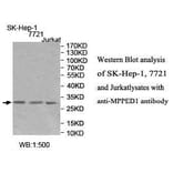 MPPED1 Antibody from Signalway Antibody (39994) - Antibodies.com