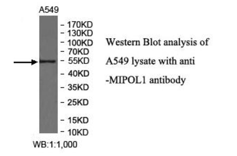 MIPOL1 Antibody from Signalway Antibody (40010) - Antibodies.com