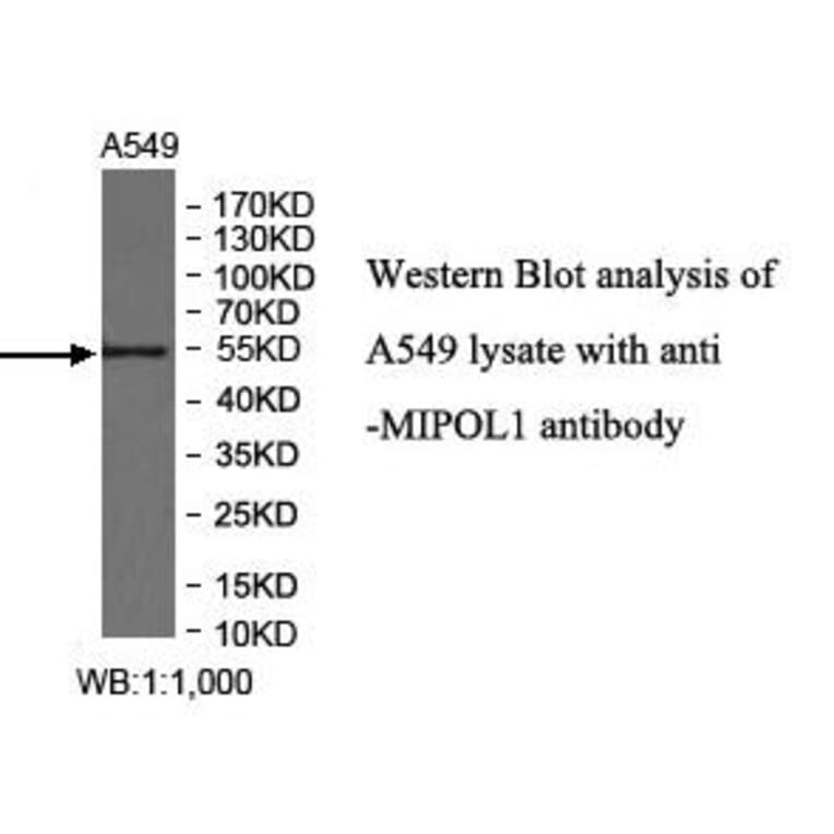 MIPOL1 Antibody from Signalway Antibody (40010) - Antibodies.com