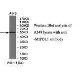 MIPOL1 Antibody from Signalway Antibody (40010) - Antibodies.com