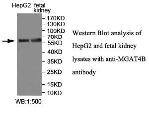 Anti-MGAT4B Antibody