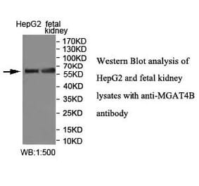 MGAT4B Antibody from Signalway Antibody (40011) - Antibodies.com