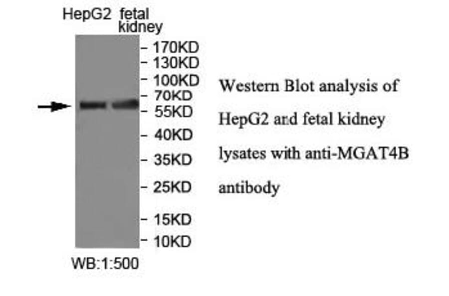MGAT4B Antibody from Signalway Antibody (40011) - Antibodies.com