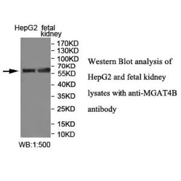 MGAT4B Antibody from Signalway Antibody (40011) - Antibodies.com