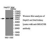 MGAT4B Antibody from Signalway Antibody (40011) - Antibodies.com