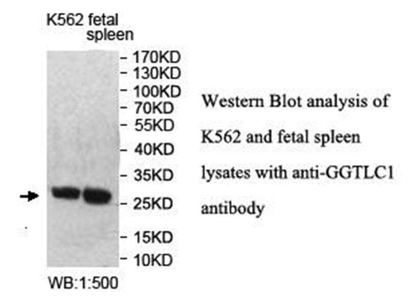 Anti-GGTLC1 Antibody
