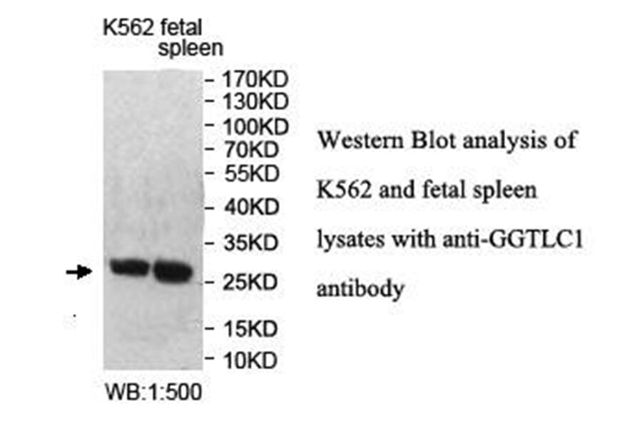GGTLC1 Antibody from Signalway Antibody (40020) - Antibodies.com