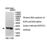 GGTLC1 Antibody from Signalway Antibody (40020) - Antibodies.com