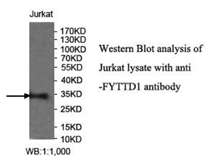 Anti-FYTTD1 Antibody
