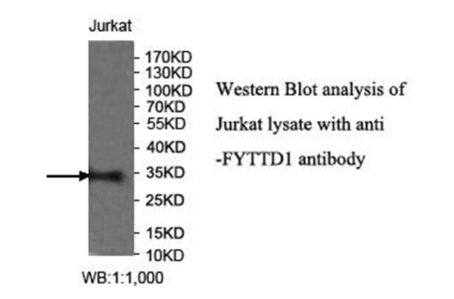 FYTTD1 Antibody from Signalway Antibody (40031) - Antibodies.com