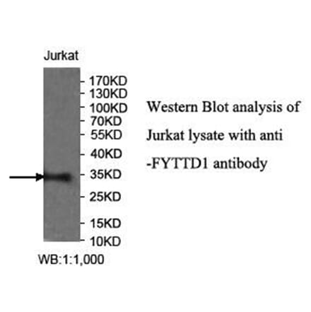 FYTTD1 Antibody from Signalway Antibody (40031) - Antibodies.com