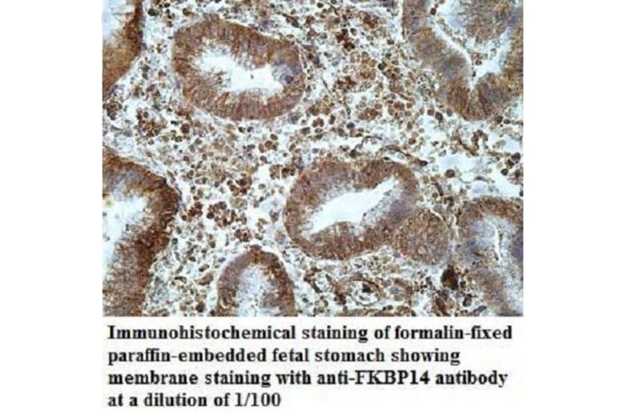 FKBP14 Antibody from Signalway Antibody (40038) - Antibodies.com