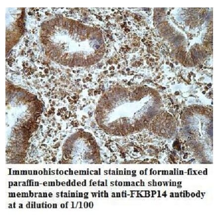 FKBP14 Antibody from Signalway Antibody (40038) - Antibodies.com