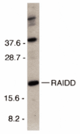 Western blot - RAIDD Antibody from Signalway Antibody (24011) - Antibodies.com