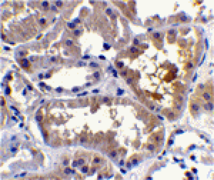 Immunohistochemistry - RAIDD Antibody from Signalway Antibody (24011) - Antibodies.com