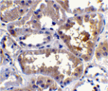 Immunohistochemistry - RAIDD Antibody from Signalway Antibody (24011) - Antibodies.com
