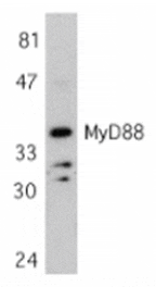 Western blot - MYD88 Antibody from Signalway Antibody (24065) - Antibodies.com