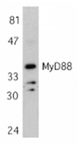 Western blot - MYD88 Antibody from Signalway Antibody (24065) - Antibodies.com